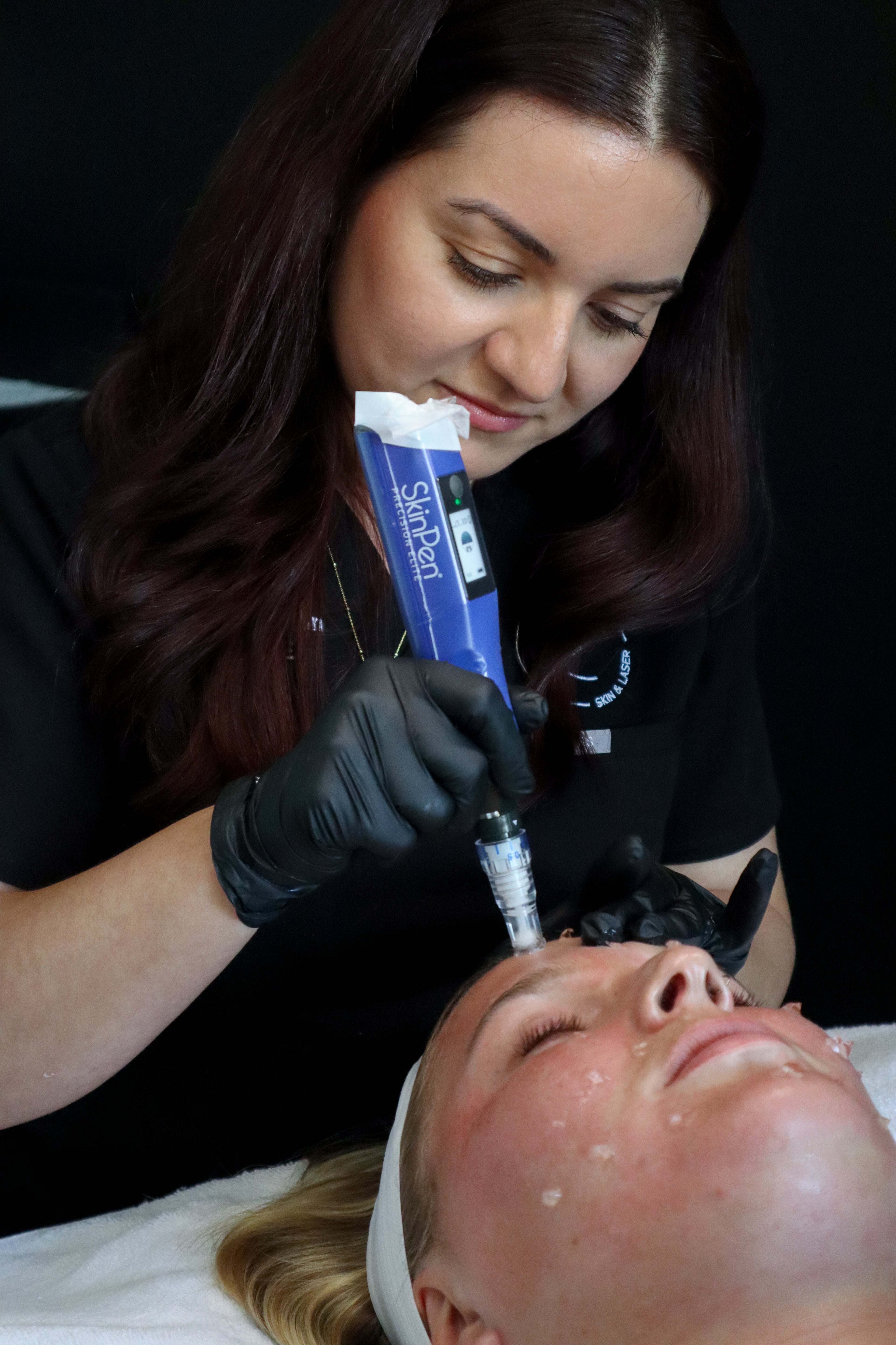 SkinPen Single Session